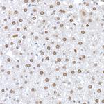 LIG3 Antibody in Immunohistochemistry (Paraffin) (IHC (P))