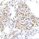 LIG3 Antibody in Immunohistochemistry (Paraffin) (IHC (P))