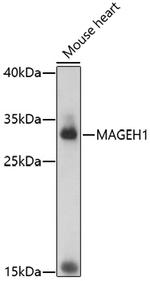 MAGEH1 Antibody in Western Blot (WB)