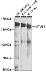 MTUS1 Antibody in Western Blot (WB)