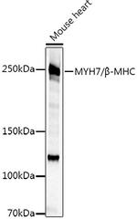 MYH7 Antibody in Western Blot (WB)