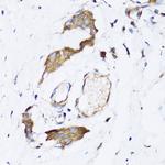 ARD1A Antibody in Immunohistochemistry (Paraffin) (IHC (P))