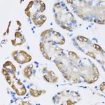 ARD1A Antibody in Immunohistochemistry (Paraffin) (IHC (P))