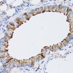 ARD1A Antibody in Immunohistochemistry (Paraffin) (IHC (P))