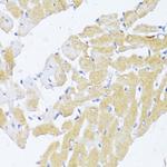 NAT2 Antibody in Immunohistochemistry (Paraffin) (IHC (P))