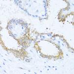 NAT2 Antibody in Immunohistochemistry (Paraffin) (IHC (P))