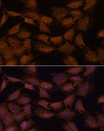 NCAPD2 Antibody in Immunocytochemistry (ICC/IF)