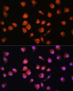 NPLOC4 Antibody in Immunocytochemistry (ICC/IF)