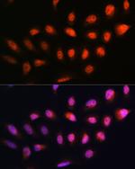 NPLOC4 Antibody in Immunocytochemistry (ICC/IF)