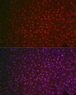 NR5A2 Antibody in Immunocytochemistry (ICC/IF)