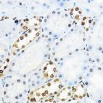 NR5A2 Antibody in Immunohistochemistry (Paraffin) (IHC (P))