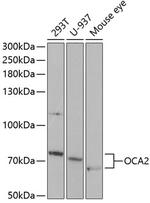 OCA2 Antibody in Western Blot (WB)