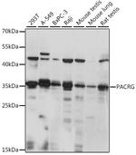 PACRG Antibody in Western Blot (WB)