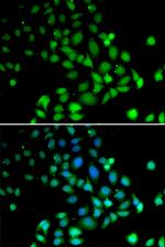 PARN Antibody in Immunocytochemistry (ICC/IF)