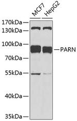 PARN Antibody in Western Blot (WB)