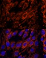 PDE6G Antibody in Immunocytochemistry (ICC/IF)