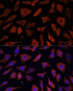 PDE6G Antibody in Immunocytochemistry (ICC/IF)