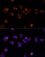 PDHA1 Antibody in Immunocytochemistry (ICC/IF)