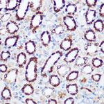 PDHA1 Antibody in Immunohistochemistry (Paraffin) (IHC (P))