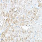 PDK4 Antibody in Immunohistochemistry (Paraffin) (IHC (P))