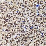 PHIP Antibody in Immunohistochemistry (Paraffin) (IHC (P))