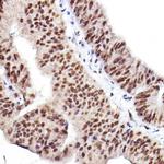 Phospho-AKT1/AKT2/AKT3 (Ser473) Antibody in Immunohistochemistry (Paraffin) (IHC (P))