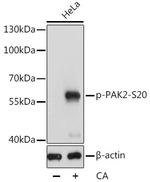 Phospho-PAK2 (Ser20) Antibody in Western Blot (WB)