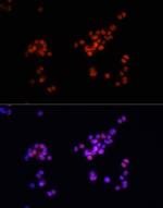 Phospho-SMAD2/SMAD3 (Ser465, Ser467, Ser423, Ser425) Antibody in Immunocytochemistry (ICC/IF)
