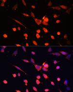 PI3K p55 gamma Antibody in Immunocytochemistry (ICC/IF)