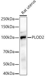 PLOD2 Antibody in Western Blot (WB)