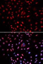 POLD1 Antibody in Immunocytochemistry (ICC/IF)