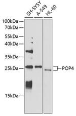 POP4 Antibody in Western Blot (WB)