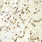 RPA2 Antibody in Immunohistochemistry (Paraffin) (IHC (P))