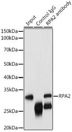 RPA2 Antibody in Immunoprecipitation (IP)