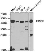 PROCR Antibody in Western Blot (WB)