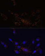 PSMB7 Antibody in Immunocytochemistry (ICC/IF)