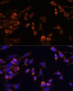 PSMB7 Antibody in Immunocytochemistry (ICC/IF)