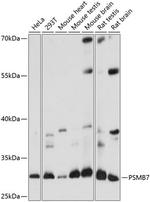 PSMB7 Antibody in Western Blot (WB)