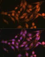 PSMD13 Antibody in Immunocytochemistry (ICC/IF)