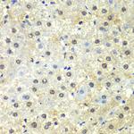 PSMD13 Antibody in Immunohistochemistry (Paraffin) (IHC (P))