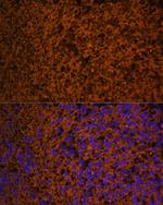 PTCH Antibody in Immunocytochemistry (ICC/IF)