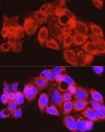 PYGL Antibody in Immunocytochemistry (ICC/IF)