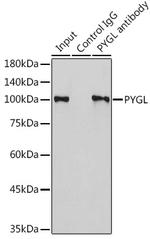 PYGL Antibody in Immunoprecipitation (IP)