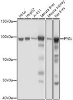 PYGL Antibody in Western Blot (WB)