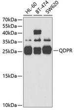 QDPR Antibody in Western Blot (WB)