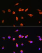 RAB20 Antibody in Immunocytochemistry (ICC/IF)