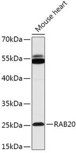 RAB20 Antibody in Western Blot (WB)