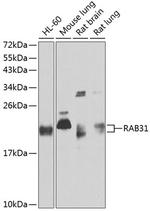 RAB31 Antibody in Western Blot (WB)