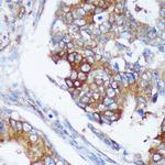 RABGAP1 Antibody in Immunohistochemistry (Paraffin) (IHC (P))