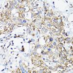 RAMP2 Antibody in Immunohistochemistry (Paraffin) (IHC (P))